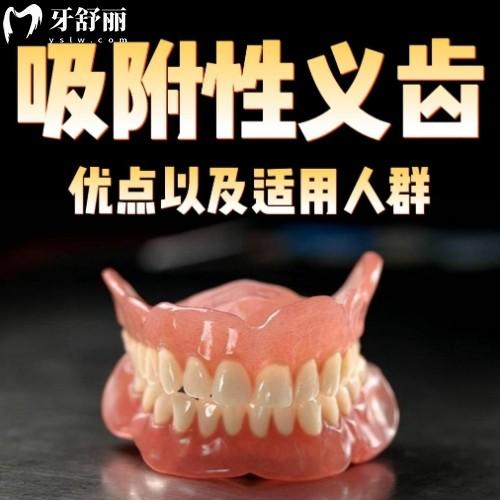 bps吸附性義齒5大優(yōu)缺點(diǎn)全解析，看完就明白適不適合自己啦